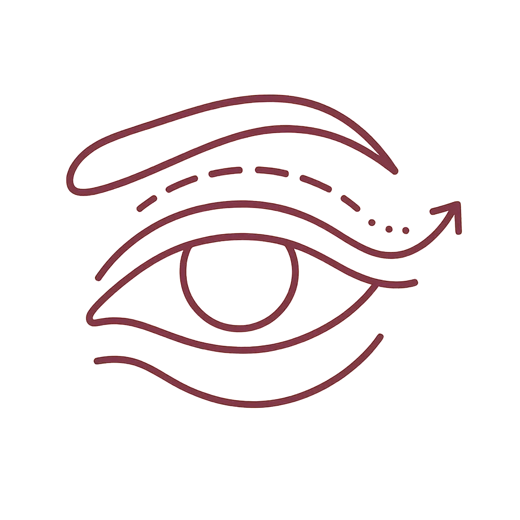 Blepharoplasty illustration