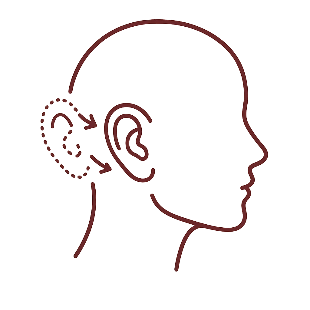 Otoplasty illustration